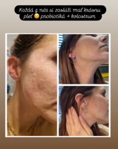 5893126315223747332 121