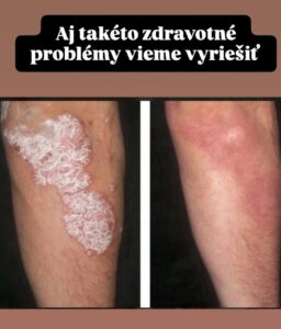 5924796162815151729 121