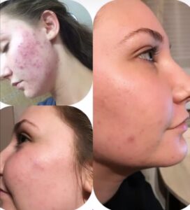 5965445928032782162 121