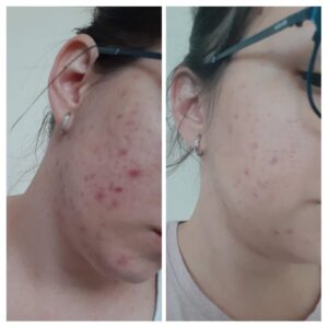 5965445928032782164 121